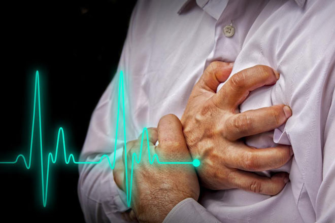symptoms of heart attack