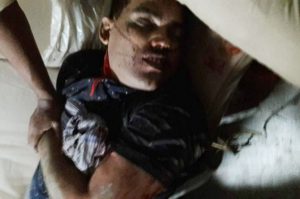 social-bihar-encounter-policeman-shot-dead-in-salarpur