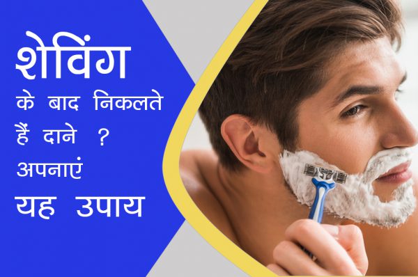 शेविंग के बाद निकलते हैं दाने ? अपनाएं यह उपाय
