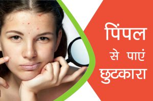 पिंपल से पाएं छुटकारा
