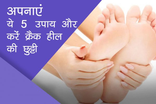 अपनाएं ये 5 उपाय और करें क्रैक हील की छुट्टी