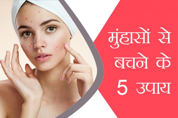 मुंहासों से बचने के लिए अपनाएं ये 5 उपाय