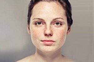 brown-spot1