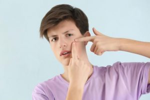 Skin Care tips for Teenagers
