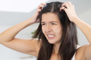 hair-loss-due-to-dandruff