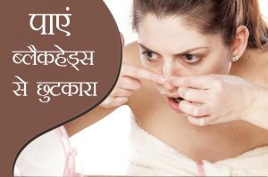 blackhead