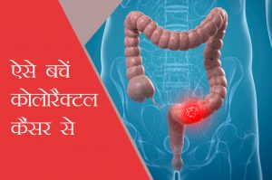 prevention of colorectal cancer