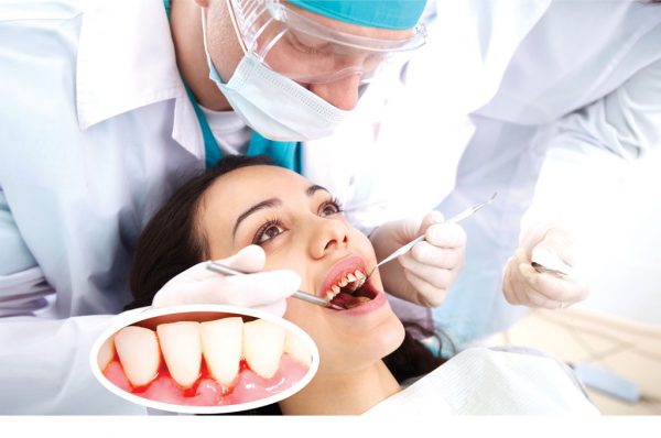मसूड़े से खून आने पर क्या करें