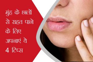 mouth-ulcer