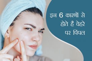 pimple