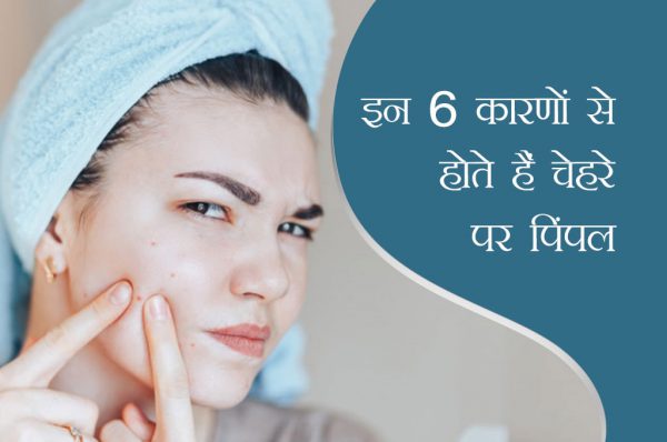 इन 6 कारणों से होते हैं चेहरे पर पिंपल