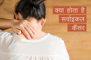 cervical cancer