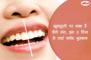 19 दिन 19 टिप्स: खूबसूरती पर धब्बा हैं पीले दांत, ऐसे लाएं सफेद मुस्कान