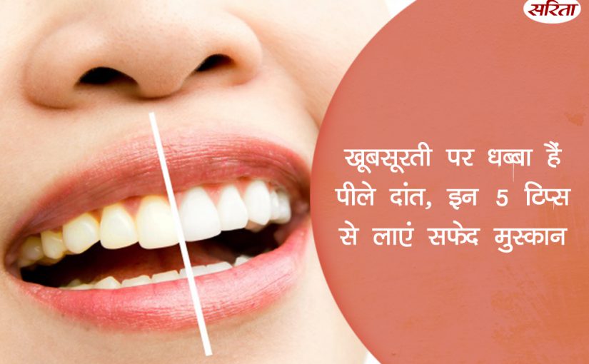 19 दिन 19 टिप्स: खूबसूरती पर धब्बा हैं पीले दांत, ऐसे लाएं सफेद मुस्कान