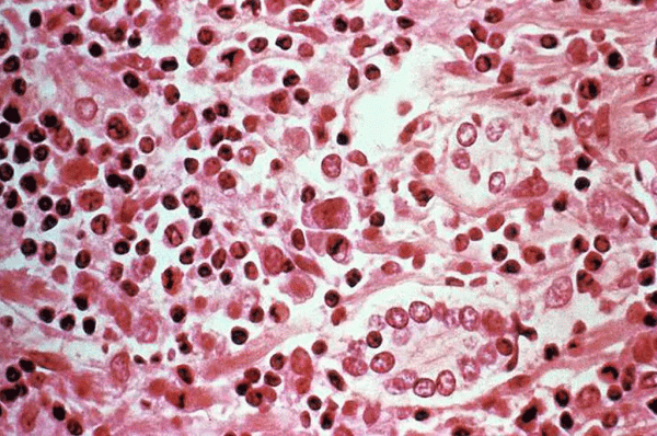 #Hantavirus: कोरोना वायरस के बाद अब हंता वायरस का कहर, सावधान रहें