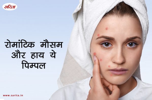 मानसून स्पेशल: रोमांटिक मौसम और हाय ये पिम्पल