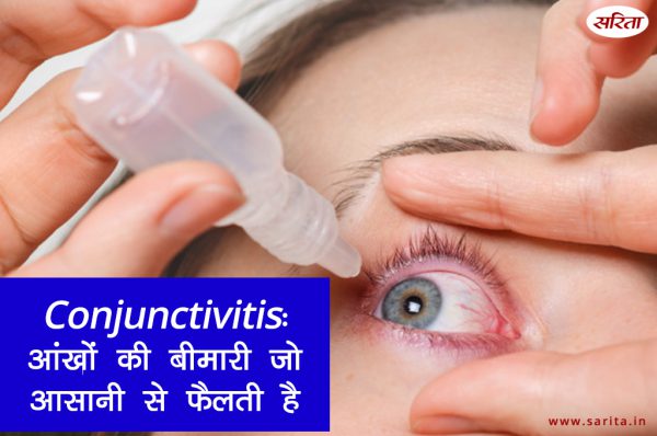 Conjunctivitis: आंखों की बीमारी जो आसानी से फैलती है