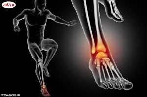 Varicose veins: वेरीकोस वेन्स यानी पैरों में सूजन और दर्द, जानें कारण और इलाज