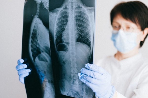 फेफड़ों को साफ व मजबूत बनाने के लिए अपनाएं ये 3 तरीके
