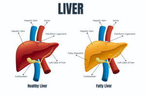 World Liver Day 2024 : क्या आपको पता है लिवर से जुड़ी ये जरूरी बातें
