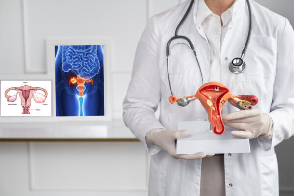 Women Health Tips: पीरियड्स का न आना ओवरी कैंसर का संकेत तो नहीं