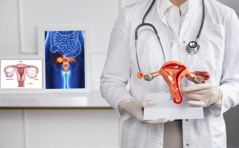Women Health Tips: पीरियड्स का न आना ओवरी कैंसर का संकेत तो नहीं