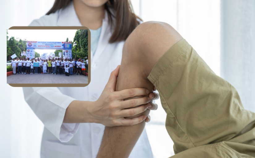 Vascular Day : वैस्कुलर डिजीज से बचना है तो पैरों को सुरक्षित रखें