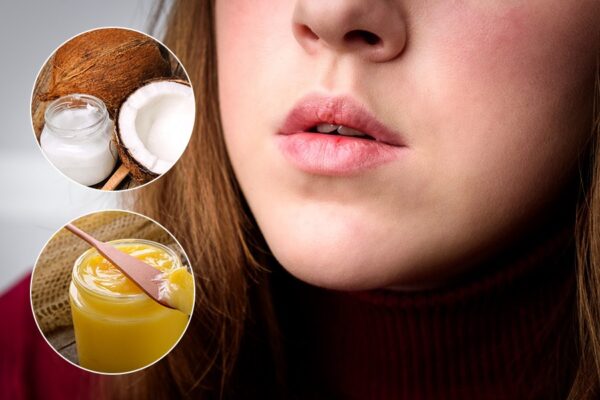 Beauty Tips : सर्दी में मेरे होंठ बहुत ही सूखे और फटे हुए रहते हैं, कैसे छुटकारा पाया जाए?