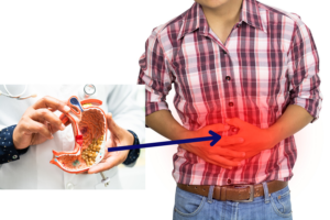 Men’s Health : पुरुषों में पेट के कैंसर का जोखिम डबल