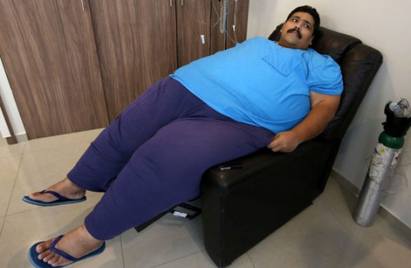 बिना सर्जरी के वजन घटाने की अनोखी तकनीक