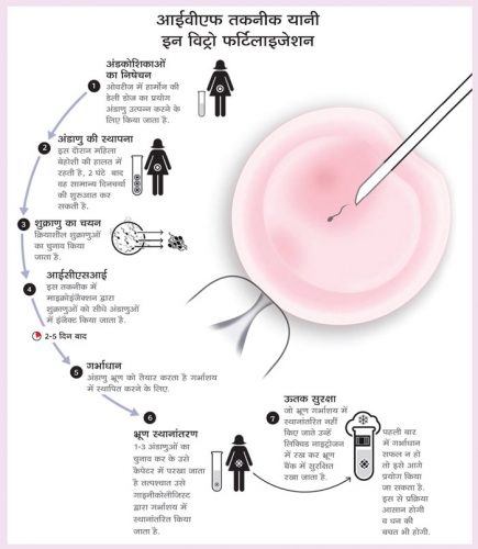 आईवीएफ तकनीक भरे सूनी गोद